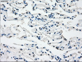 CD32A Antibody - IHC of paraffin-embedded lung tissue using anti-FCGR2A mouse monoclonal antibody. (Dilution 1:50).