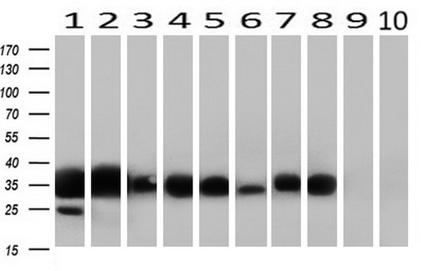 CD32A Antibody - Western blot analysis of extracts. (10ug) from 10 Human tissue by using anti-FCGR2A monoclonal antibody at 1:500. (1: Testis; 2: Omentum; 3: Uterus; 4: Breast; 5: Brain; 6: Liver; 7: Ovary; 8: Thyroid gland; 9: colon;10: spleen).