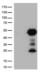 CD32A Antibody - HEK293T cells were transfected with the pCMV6-ENTRY control. (Left lane) or pCMV6-ENTRY FCGR2A. (Right lane) cDNA for 48 hrs and lysed. Equivalent amounts of cell lysates. (5 ug per lane) were separated by SDS-PAGE and immunoblotted with anti-FCGR2A. (1:500)