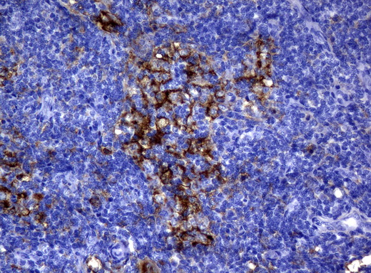 CD32A Antibody - Immunohistochemical staining of paraffin-embedded Human lymph node tissue using anti-FCGR2A mouse monoclonal antibody.  heat-induced epitope retrieval by 10mM citric buffer, pH6.0, 120C for 3min)