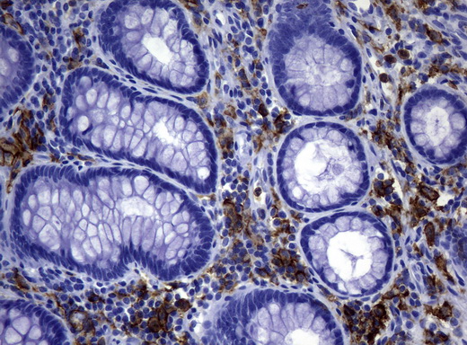 CD32A Antibody - Immunohistochemical staining of paraffin-embedded Human colon tissue using anti-FCGR2A mouse monoclonal antibody.  heat-induced epitope retrieval by 10mM citric buffer, pH6.0, 120C for 3min)