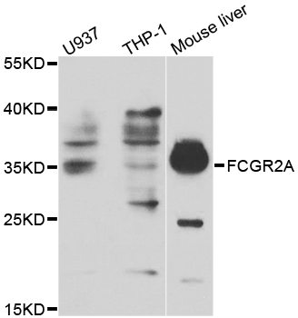 CD32A Antibody - Western blot analysis of extracts of various cell lines, using FCGR2A antibody at 1:1000 dilution. The secondary antibody used was an HRP Goat Anti-Rabbit IgG (H+L) at 1:10000 dilution. Lysates were loaded 25ug per lane and 3% nonfat dry milk in TBST was used for blocking.