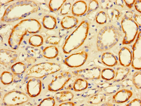 CD32A Antibody - Immunohistochemistry of paraffin-embedded human kidney tissue using FCGR2A Antibody at dilution of 1:100