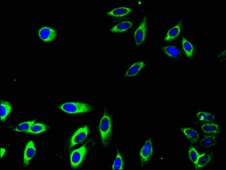 CD32A Antibody - Immunofluorescent analysis of Hela cells using FCGR2A Antibody at a dilution of 1:100 and Alexa Fluor 488-congugated AffiniPure Goat Anti-Rabbit IgG(H+L)