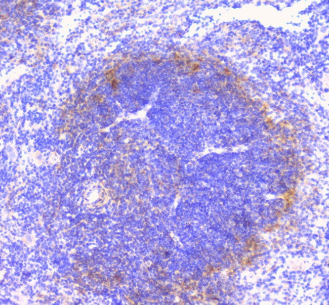 CD32A Antibody - IHC analysis of FCGR2A using anti-FCGR2A antibody. FCGR2A was detected in paraffin-embedded section of mouse spleen tissue. Heat mediated antigen retrieval was performed in citrate buffer (pH6, epitope retrieval solution) for 20 mins. The tissue section was blocked with 10% goat serum. The tissue section was then incubated with 1µg/ml rabbit anti-FCGR2A Antibody overnight at 4°C. Biotinylated goat anti-rabbit IgG was used as secondary antibody and incubated for 30 minutes at 37°C. The tissue section was developed using Strepavidin-Biotin-Complex (SABC) with DAB as the chromogen.