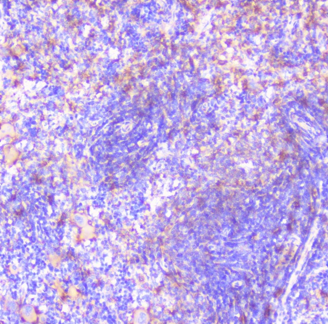 CD32A Antibody - IHC analysis of FCGR2A using anti-FCGR2A antibody. FCGR2A was detected in paraffin-embedded section of rat spleen tissue. Heat mediated antigen retrieval was performed in citrate buffer (pH6, epitope retrieval solution) for 20 mins. The tissue section was blocked with 10% goat serum. The tissue section was then incubated with 1µg/ml rabbit anti-FCGR2A Antibody overnight at 4°C. Biotinylated goat anti-rabbit IgG was used as secondary antibody and incubated for 30 minutes at 37°C. The tissue section was developed using Strepavidin-Biotin-Complex (SABC) with DAB as the chromogen.