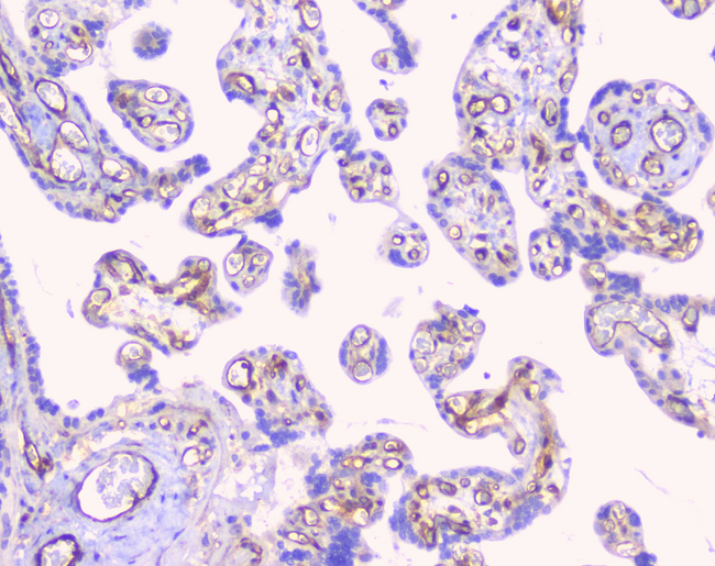 CD32A Antibody - IHC analysis of FCGR2A using anti-FCGR2A antibody. FCGR2A was detected in paraffin-embedded section of human placenta tissue. Heat mediated antigen retrieval was performed in citrate buffer (pH6, epitope retrieval solution) for 20 mins. The tissue section was blocked with 10% goat serum. The tissue section was then incubated with 1µg/ml rabbit anti-FCGR2A Antibody overnight at 4°C. Biotinylated goat anti-rabbit IgG was used as secondary antibody and incubated for 30 minutes at 37°C. The tissue section was developed using Strepavidin-Biotin-Complex (SABC) with DAB as the chromogen.