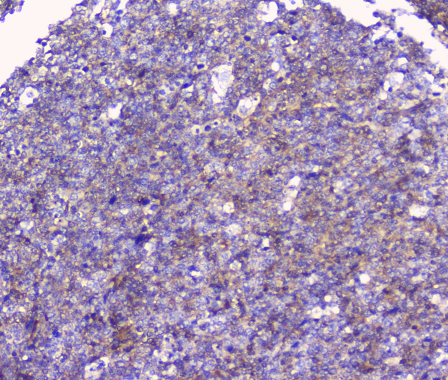 CD32A Antibody - IHC analysis of FCGR2A using anti-FCGR2A antibody. FCGR2A was detected in paraffin-embedded section of human tonsil tissue. Heat mediated antigen retrieval was performed in citrate buffer (pH6, epitope retrieval solution) for 20 mins. The tissue section was blocked with 10% goat serum. The tissue section was then incubated with 1µg/ml rabbit anti-FCGR2A Antibody overnight at 4°C. Biotinylated goat anti-rabbit IgG was used as secondary antibody and incubated for 30 minutes at 37°C. The tissue section was developed using Strepavidin-Biotin-Complex (SABC) with DAB as the chromogen.