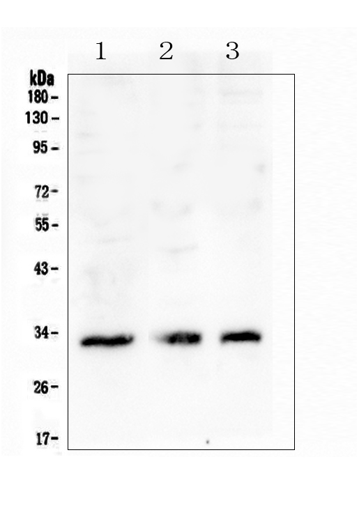 CD32A Antibody - Western blot analysis of FCGR2A using anti-FCGR2A antibody. Electrophoresis was performed on a 5-20% SDS-PAGE gel at 70V (Stacking gel) / 90V (Resolving gel) for 2-3 hours. The sample well of each lane was loaded with 50ug of sample under reducing conditions. Lane 1: human K562 whole cell lysate,Lane 2: human Caco-2 whole cell lysate,Lane 3: human U20S whole cell lysate. After Electrophoresis, proteins were transferred to a Nitrocellulose membrane at 150mA for 50-90 minutes. Blocked the membrane with 5% Non-fat Milk/ TBS for 1.5 hour at RT. The membrane was incubated with rabbit anti-FCGR2A antigen affinity purified polyclonal antibody at 0.5 µg/mL overnight at 4°C, then washed with TBS-0.1% Tween 3 times with 5 minutes each and probed with a goat anti-rabbit IgG-HRP secondary antibody at a dilution of 1:10000 for 1.5 hour at RT. The signal is developed using an Enhanced Chemiluminescent detection (ECL) kit with Tanon 5200 system. A specific band was detected for FCGR2A at approximately 33KD. The expected band size for FCGR2A is at 35KD.