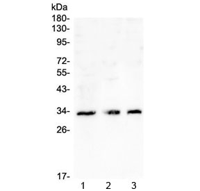 CD32A Antibody - Western blot testing of 1) K562, 2) Caco-2 and 3) U-2 OS cell lysate with CD32 antibody at 0.5ug/ml. Predicted molecular weight: 34-40 kDa depending on the level of glycosylation.