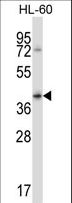 CD32B Antibody - FCGR2B Antibody western blot of HL-60 cell line lysates (35 ug/lane). The FCGR2B antibody detected the FCGR2B protein (arrow).