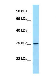 CD32B Antibody - FCGR2B / CD32B antibody Western blot of Fetal Lung lysate. Antibody concentration 1 ug/ml.  This image was taken for the unconjugated form of this product. Other forms have not been tested.