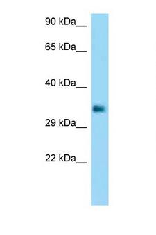 CD32B Antibody - FCGR2B / CD32B antibody western blot of Placenta lysate. Antibody concentration 1 ug/ml.  This image was taken for the unconjugated form of this product. Other forms have not been tested.