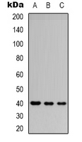 CD32B Antibody - Western blot analysis of CD32b expression in Jurkat (A); SHSY5Y (B); HEK293T (C) whole cell lysates.