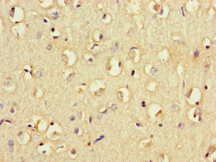 CD32B Antibody - Immunohistochemistry of paraffin-embedded human brain tissue at dilution of 1:100