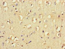 CD32B Antibody - Immunohistochemistry of paraffin-embedded human brain tissue at dilution of 1:100