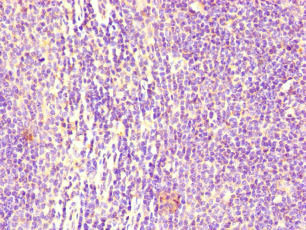 CD32B Antibody - Immunohistochemistry of paraffin-embedded human lymph node tissue at dilution of 1:100
