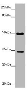 CD32B Antibody - Western blot All Lanes :FCGR2B antibody at 2 ug/ml+Mouse liver tissue Secondary Goat polyclonal to rabbit at 1/10000 dilution Predicted band size: 35,32,34 kDa Observed band size: 34,50 kDa