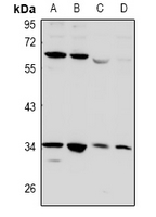 CD32B Antibody - Western blot analysis of CD32b expression in PC12 (A), SP20 (B), THP1 (C), MCF7 (D) whole cell lysates.