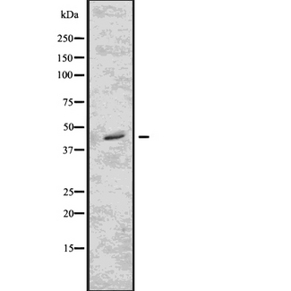 CD32B Antibody - Western blot analysis of FCGR2B using Jurkat whole lysates.