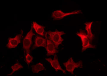 CD32B Antibody - Staining HeLa cells by IF/ICC. The samples were fixed with PFA and permeabilized in 0.1% Triton X-100, then blocked in 10% serum for 45 min at 25°C. The primary antibody was diluted at 1:200 and incubated with the sample for 1 hour at 37°C. An Alexa Fluor 594 conjugated goat anti-rabbit IgG (H+L) Ab, diluted at 1/600, was used as the secondary antibody.