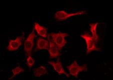 CD32B Antibody - Staining HeLa cells by IF/ICC. The samples were fixed with PFA and permeabilized in 0.1% Triton X-100, then blocked in 10% serum for 45 min at 25°C. The primary antibody was diluted at 1:200 and incubated with the sample for 1 hour at 37°C. An Alexa Fluor 594 conjugated goat anti-rabbit IgG (H+L) Ab, diluted at 1/600, was used as the secondary antibody.
