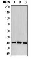 CD32B Antibody - Western blot analysis of CD32b (pY292) expression in MCF7 pervanadate-treated (A); mouse liver (B); PC12 pervanadate-treated (C) whole cell lysates.