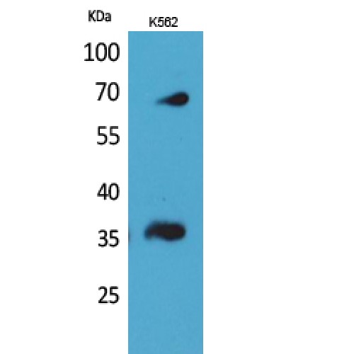 CD32B + CD32C Antibody - Western blot of CD32-B/C antibody