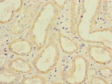 CD32C Antibody - Immunohistochemistry of paraffin-embedded human kidney tissue at dilution 1:100