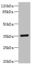CD32C Antibody - Western blot All Lanes: FCGR2C antibody IgG at 1.67ug/ml+ Human Burkitt lymphoma cells Secondary Goat polyclonal to rabbit IgG at 1/10000 dilution Predicted band size: 36,31,30,26 kDa Observed band size: 36 kDa