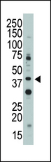 CD33 Antibody - The anti-Siglec3 N-term antibody is used in Western blot to detect Siglec3 in Jurkat cell lysate.