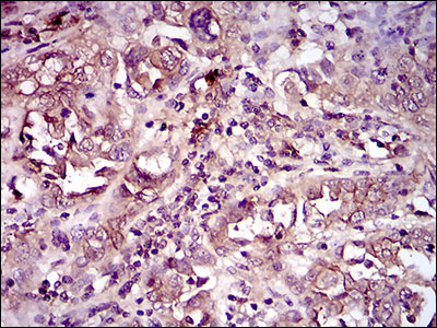 CD33 Antibody - IHC of paraffin-embedded endometrium tissues using CD33 mouse monoclonal antibody with DAB staining.