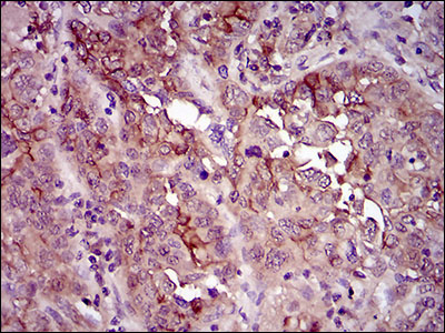 CD33 Antibody - IHC of paraffin-embedded endometrium tissues using CD33 mouse monoclonal antibody with DAB staining.