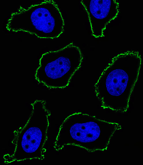 CD33 Antibody - Fluorescent image of A549 cell stained with CD33 Antibody. A549 cells were fixed with 4% PFA (20 min), permeabilized with Triton X-100 (0.1%, 10 min), then incubated with CD33 primary antibody (1:25, 1 h at 37°C). For secondary antibody, Alexa Fluor 488 conjugated donkey anti-mouse antibody (green) was used (1:400, 50 min at 37°C). Nuclei were counterstained with DAPI (blue) (10 ug/ml, 10 min). CD33 immunoreactivity is localized to Membrane significantly.
