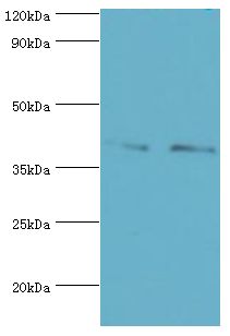CD33 Antibody - Western blot. All lanes: Myeloid cell surface antigen CD33 antibody at 8 ug/ml. Lane 1: K562 whole cell lysate. Lane 2: HepG2 whole cell lysate. Secondary antibody: Goat polyclonal to rabbit at 1:10000 dilution. Predicted band size: 40 kDa. Observed band size: 40 kDa Immunohistochemistry.