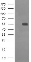 CD33 Antibody - HEK293T cells were transfected with the pCMV6-ENTRY control (Left lane) or pCMV6-ENTRY CD33 (Right lane) cDNA for 48 hrs and lysed. Equivalent amounts of cell lysates (5 ug per lane) were separated by SDS-PAGE and immunoblotted with anti-CD33.