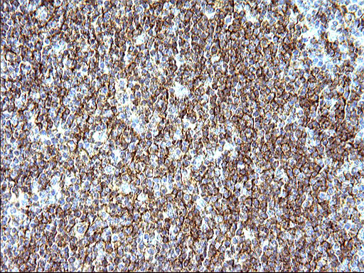 CD33 Antibody - IHC of paraffin-embedded Human lymph node tissue using anti-CD33 mouse monoclonal antibody. (Heat-induced epitope retrieval by 10mM citric buffer, pH6.0, 120°C for 3min).