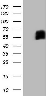 CD33 Antibody - HEK293T cells were transfected with the pCMV6-ENTRY control. (Left lane) or pCMV6-ENTRY CD33. (Right lane) cDNA for 48 hrs and lysed. Equivalent amounts of cell lysates. (5 ug per lane) were separated by SDS-PAGE and immunoblotted with anti-CD33.