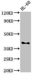 CD33 Antibody - Positive Western Blot detected in HL-60 whole cell lysate. All lanes: CD33 antibody at 3 µg/ml Secondary Goat polyclonal to rabbit IgG at 1/50000 dilution. Predicted band size: 40, 34, 26 KDa. Observed band size: 40 KDa