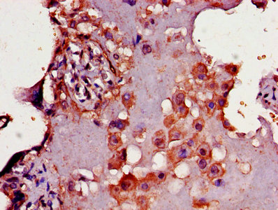CD33 Antibody - IHC image of CD33 Antibody diluted at 1:300 and staining in paraffin-embedded human placenta tissue performed on a Leica BondTM system. After dewaxing and hydration, antigen retrieval was mediated by high pressure in a citrate buffer (pH 6.0). Section was blocked with 10% normal goat serum 30min at RT. Then primary antibody (1% BSA) was incubated at 4°C overnight. The primary is detected by a biotinylated secondary antibody and visualized using an HRP conjugated SP system.