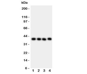 CD34 Antibody - Western blot testing of CD34 antibody and Lane 1: MCF-7; 2: MM231; 3: SMMC-7721; 4: HepG2 lysate. Observed size 41~110KD depending on level of glycosylation