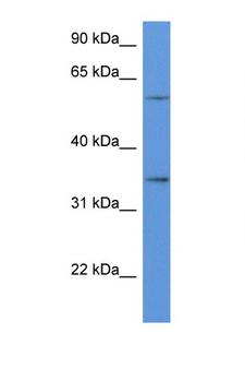 CD34 Antibody - CD34 antibody Western blot of HeLa Cell lysate. Antibody concentration 1 ug/ml.  This image was taken for the unconjugated form of this product. Other forms have not been tested.