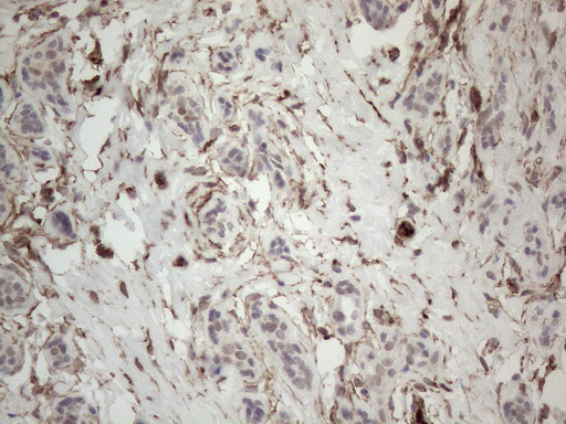 CD34 Antibody - Immunohistochemical staining of paraffin-embedded Human breast tissue within the normal limits using anti-CD34 mouse monoclonal antibody. (Heat-induced epitope retrieval by 1mM EDTA in 10mM Tris buffer. (pH8.5) at 120°C for 3 min. (1:150)
