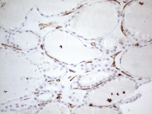 CD34 Antibody - Immunohistochemical staining of paraffin-embedded Human thyroid tissue within the normal limits using anti-CD34 mouse monoclonal antibody. (Heat-induced epitope retrieval by 1mM EDTA in 10mM Tris buffer. (pH8.5) at 120°C for 3 min. (1:150)