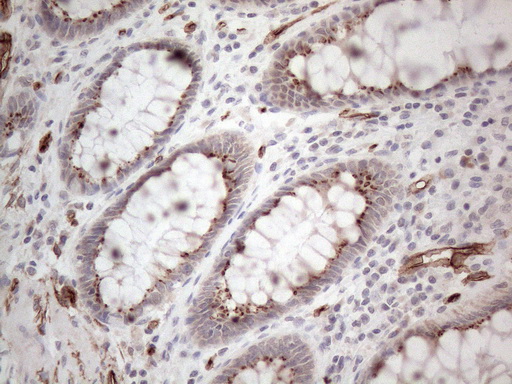 CD34 Antibody - Immunohistochemical staining of paraffin-embedded Human colon tissue within the normal limits using anti-CD34 mouse monoclonal antibody. (Heat-induced epitope retrieval by 1mM EDTA in 10mM Tris buffer. (pH8.5) at 120°C for 3 min. (1:150)