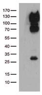 CD34 Antibody - HEK293T cells were transfected with the pCMV6-ENTRY control. (Left lane) or pCMV6-ENTRY CD34. (Right lane) cDNA for 48 hrs and lysed