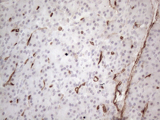 CD34 Antibody - Immunohistochemical staining of paraffin-embedded Human pancreas tissue within the normal limits using anti-CD34 mouse monoclonal antibody. (Heat-induced epitope retrieval by 1mM EDTA in 10mM Tris buffer. (pH8.5) at 120°C for 3 min. (1:150)