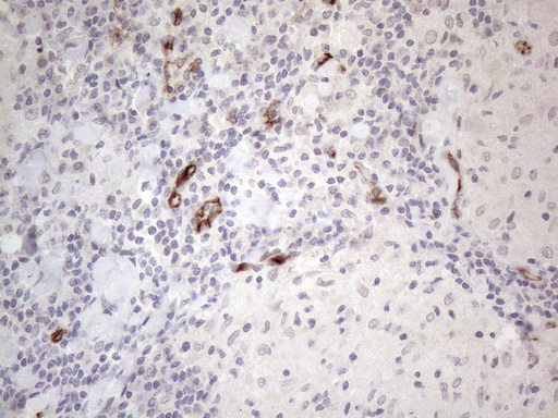 CD34 Antibody - Immunohistochemical staining of paraffin-embedded Human lymph node tissue within the normal limits using anti-CD34 mouse monoclonal antibody. (Heat-induced epitope retrieval by 1mM EDTA in 10mM Tris buffer. (pH8.5) at 120°C for 3 min. (1:150)