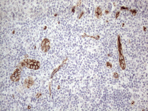 CD34 Antibody - Immunohistochemical staining of paraffin-embedded Human tonsil within the normal limits using anti-CD34 mouse monoclonal antibody. (Heat-induced epitope retrieval by 1mM EDTA in 10mM Tris buffer. (pH8.5) at 120°C for 3 min. (1:150)
