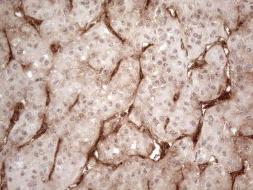 CD34 Antibody - Immunohistochemical staining of paraffin-embedded Human liver tissue within the normal limits using anti-CD34 mouse monoclonal antibody. (Heat-induced epitope retrieval by 1mM EDTA in 10mM Tris buffer. (pH8.5) at 120°C for 3 min. (1:150)